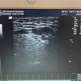 GE 7.0MHz Ultrasound Transducer Probe