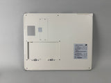 BATTERY-KV For iRay DR MARS1417V-TSI Flat Panel Detector Battery