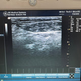 GE 7.0MHz Ultrasound Transducer Probe