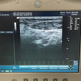 GE 7.0MHz Ultrasound Transducer Probe