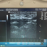 GE 7.0MHz Ultrasound Transducer Probe