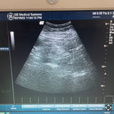 GE 3.8 MHz 3C-RS Ultrasound Transducer Probe